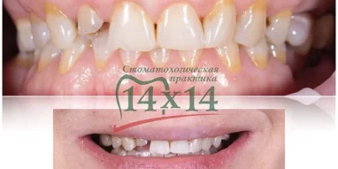 Стоматологическая практика 14х14 фотография 7
